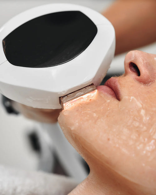 Pack De 4 Séances Lumecca Full Face - Protocole Complet