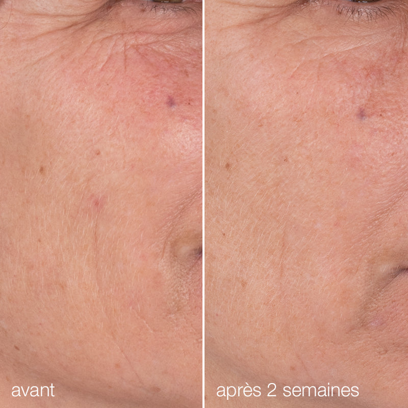 before and after