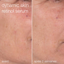 Coffret Protect + Renew | Duo Peau Protégée Et Régénérée