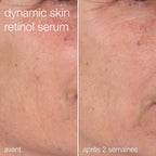 Protect + Renew Set | Protected & Renewed Skin Duo