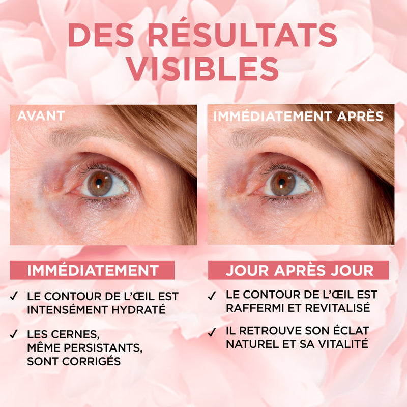 Age Perfect Golden Age Soin Yeux Rosé Éclat