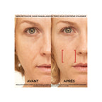 Tratamiento de día antiedad con láser Revitalift