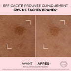 Age Perfect Sérum corrector de manchas oscuras Golden Age
