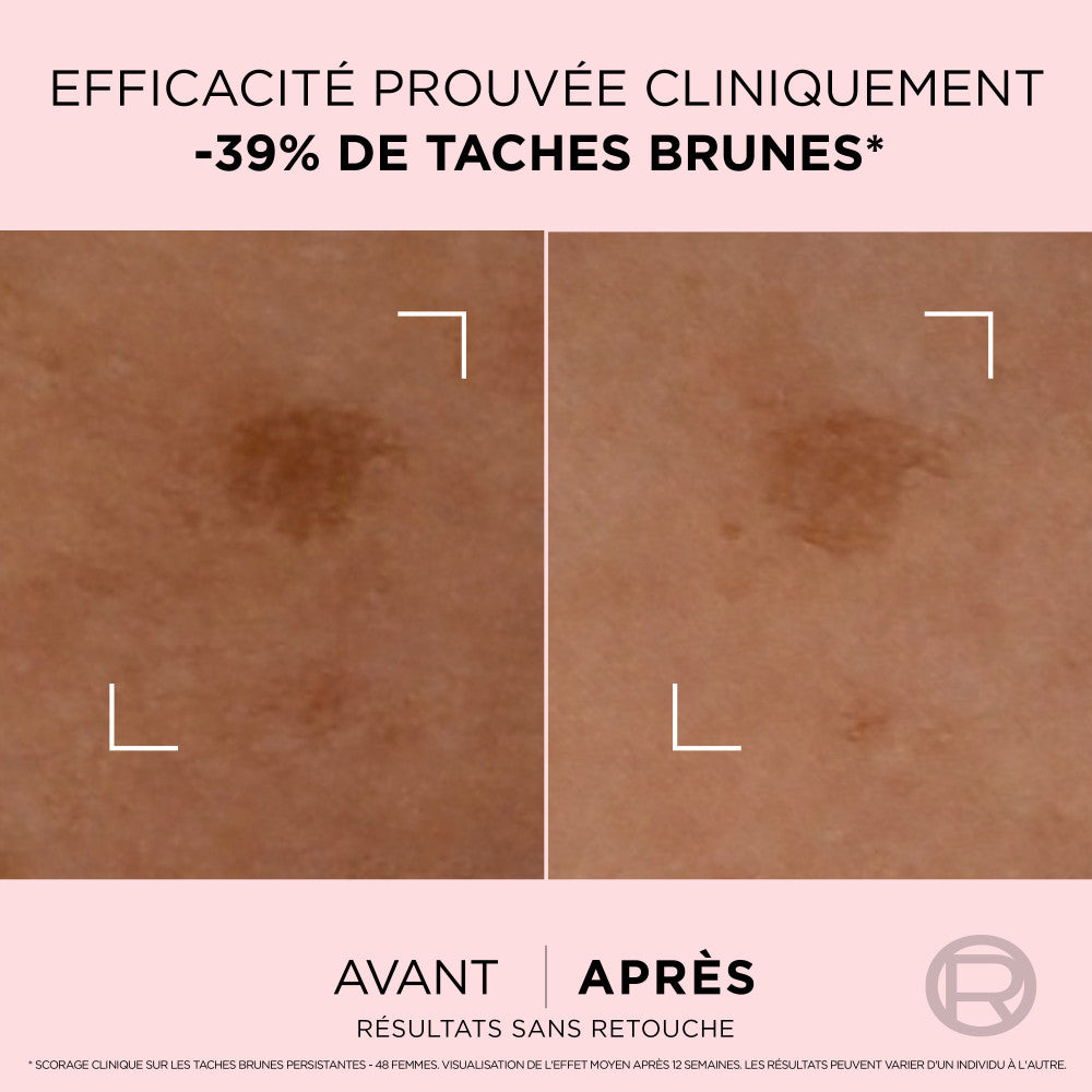 Age Perfect Sérum corrector de manchas oscuras Golden Age