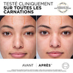 Caja de rutina clínica Revitalift - 2 productos