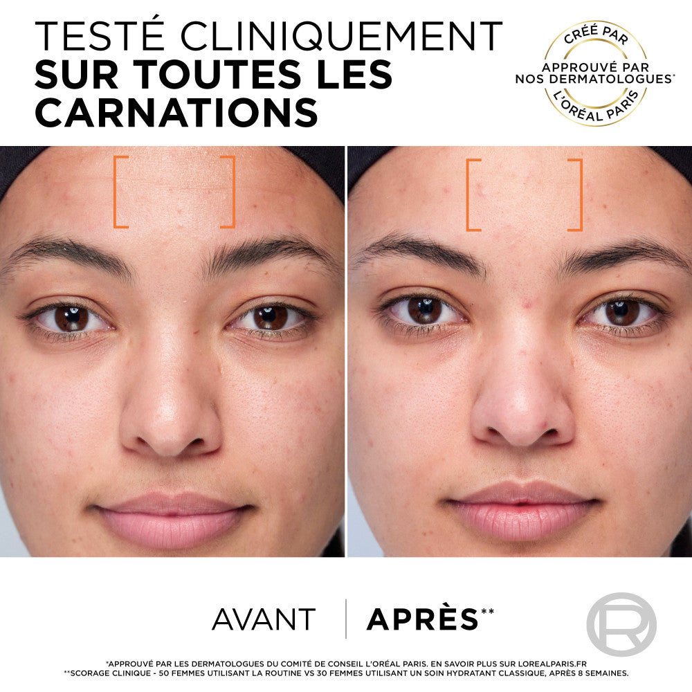 Caja de rutina clínica Revitalift - 2 productos
