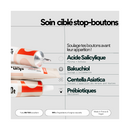 Supershtars - Les 3 Étapes Du Bouton