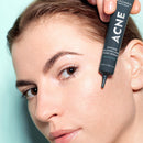 Acne Sérum Intensif Pores & Imperfections