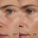 Retinol Alternative Sérum À Base De Plantes
