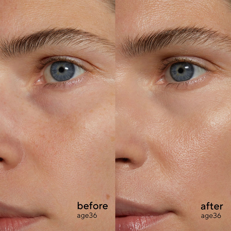 Retinol Alternative Sérum À Base De Plantes