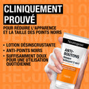 bc27b81e6529b9d24169f73a5b4910fdd95c7348