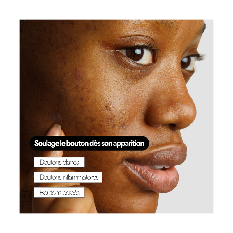 Clear Out - Patchs Boutons Hydrocolloïde