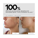 Even Out - Soin Ciblé Anti-Taches