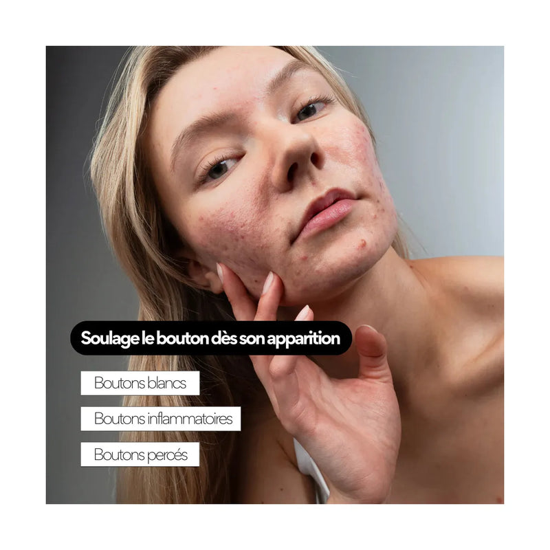 Clear Out - Soin Ciblé Stop-Boutons