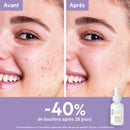 Sebiaclear Ampoule Flash Anti-Imperfections Anti-Rougeurs Lissante