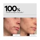 Clean Out - Routine Double Nettoyage