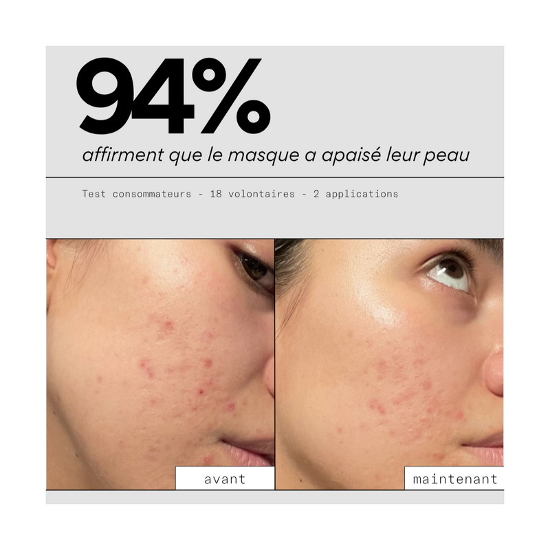 Clear Out - Masque Sos Boutons