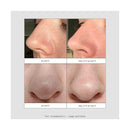 Peel Out - Patchs Nez Points Noirs Hydrocolloïde