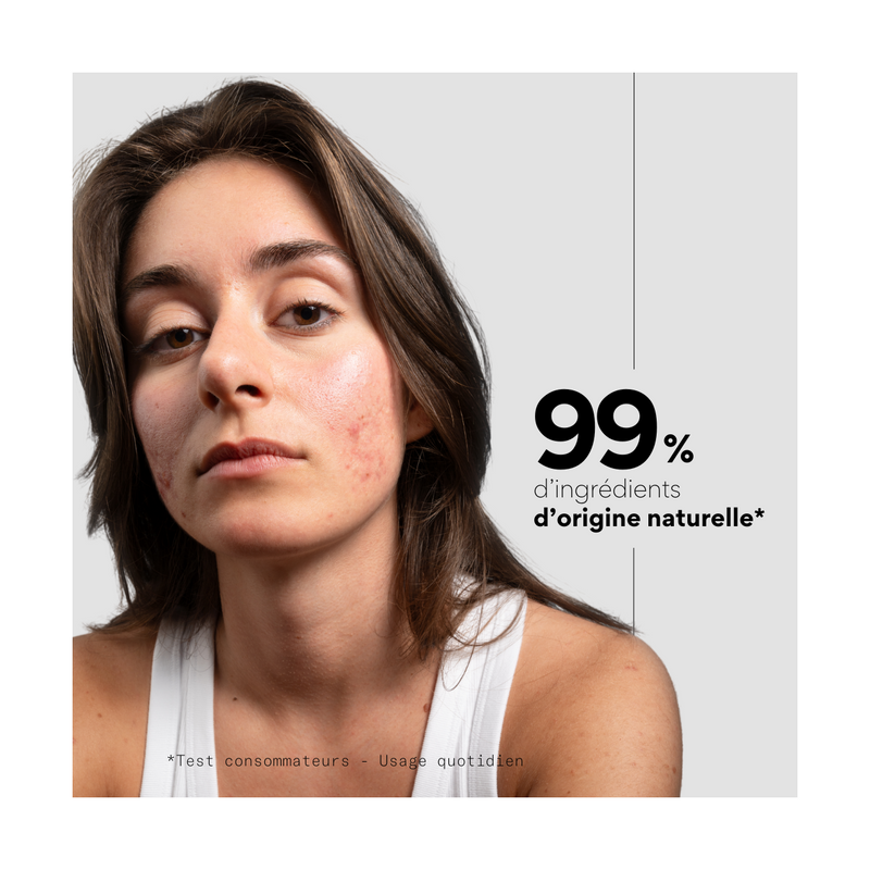 Even Out - Soin Ciblé Anti-Taches