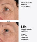 Protocolo ocular