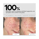 Peel Out - Routine Sos Points Noirs Et Pores