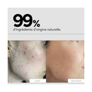 Supershtars - Les 3 Étapes Du Bouton