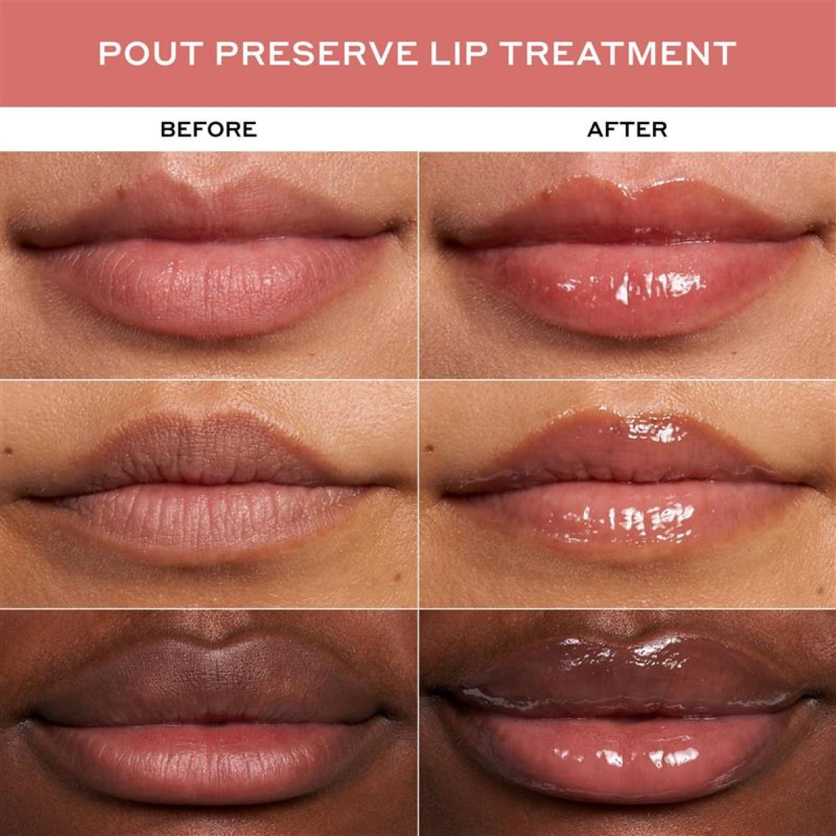 Botf Plumping Peptide Pair