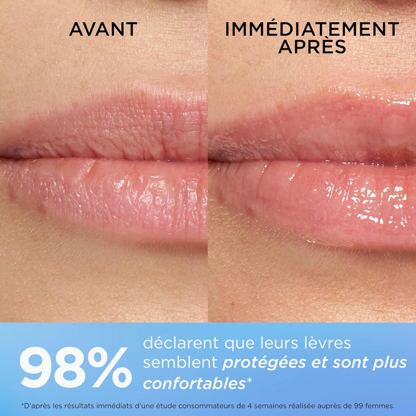 Intensive Lip Repair Balm - Eight Hour®