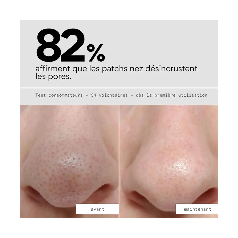 Peel Out - Routine Sos Points Noirs Et Pores