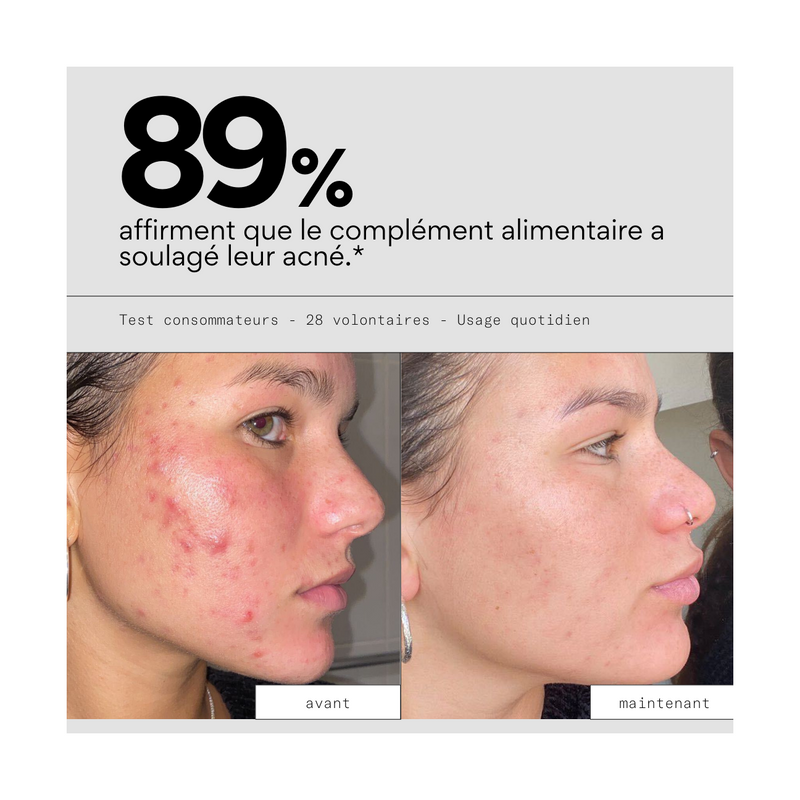 Routine In - Cure 3 Mois Compléments Alimentaires Anti-Acné