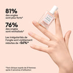 Routine iniziale - Unghie rigate