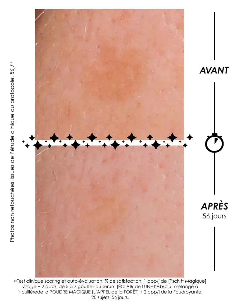 Laboratoire Garancia Day Cream [CLAIR DE LUNE La Foudroyante] Comparison before/after 56 days on the reduction of a brown spot with the Garancia protocol.