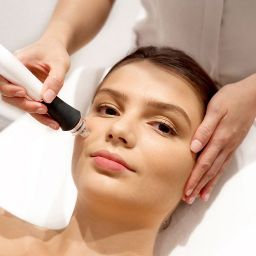 Tailor-Made Acne Treatment + Skin Diagnosis - 4 Sessions