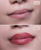 Maquillaje Permanente - Relleno de Labios - Tratamiento en Instituto