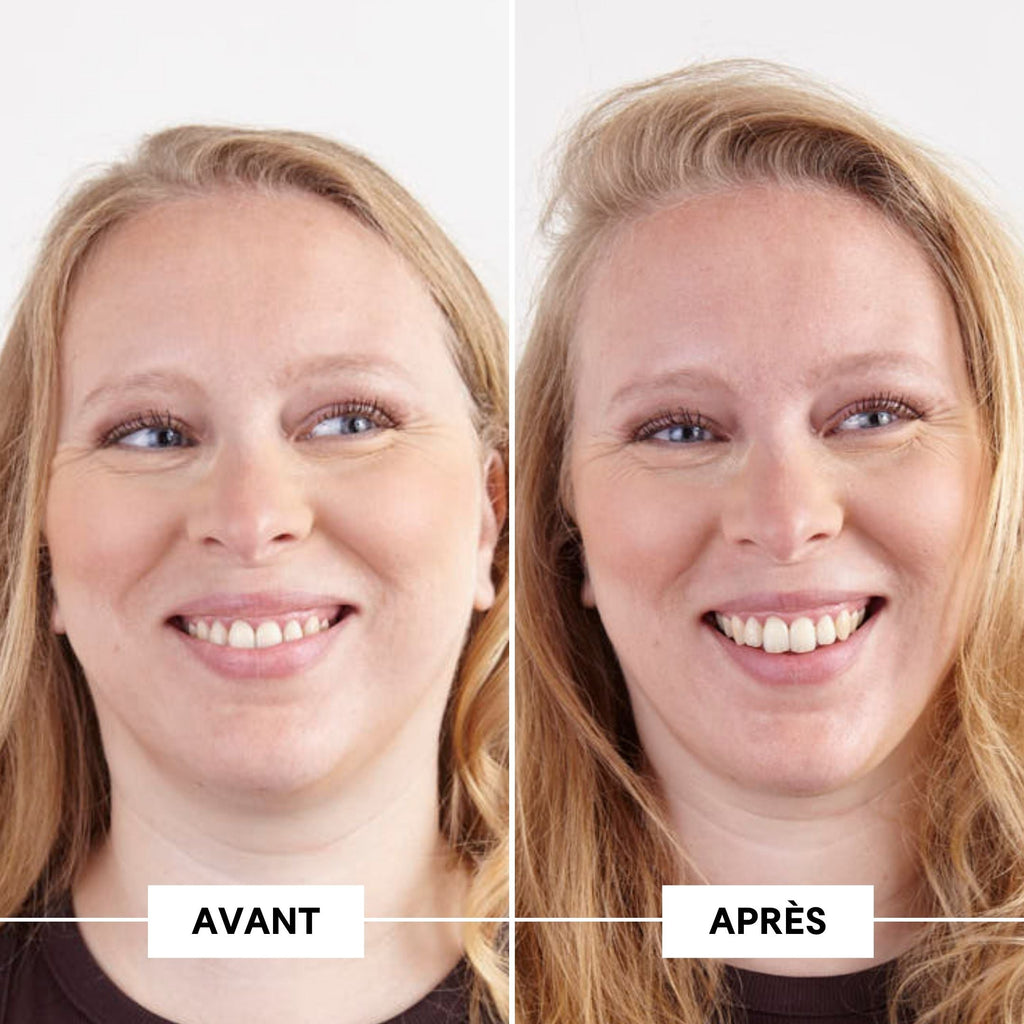 Before-after fine hair