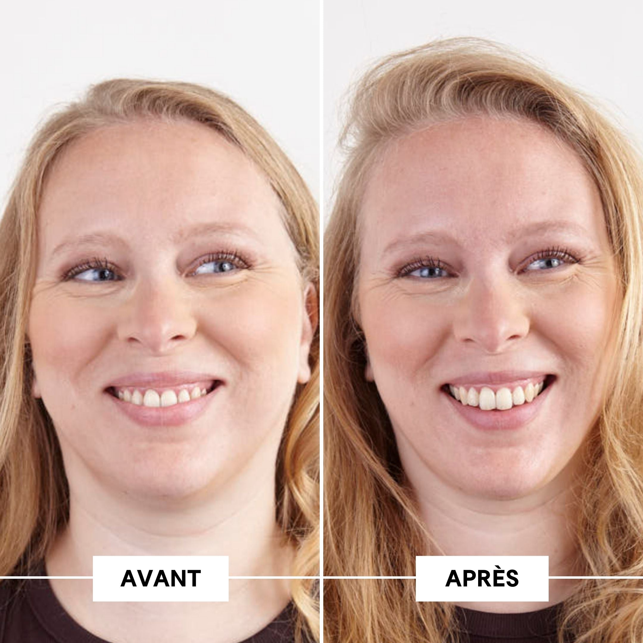Before-after fine hair