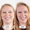 Avant-après cheveux fins