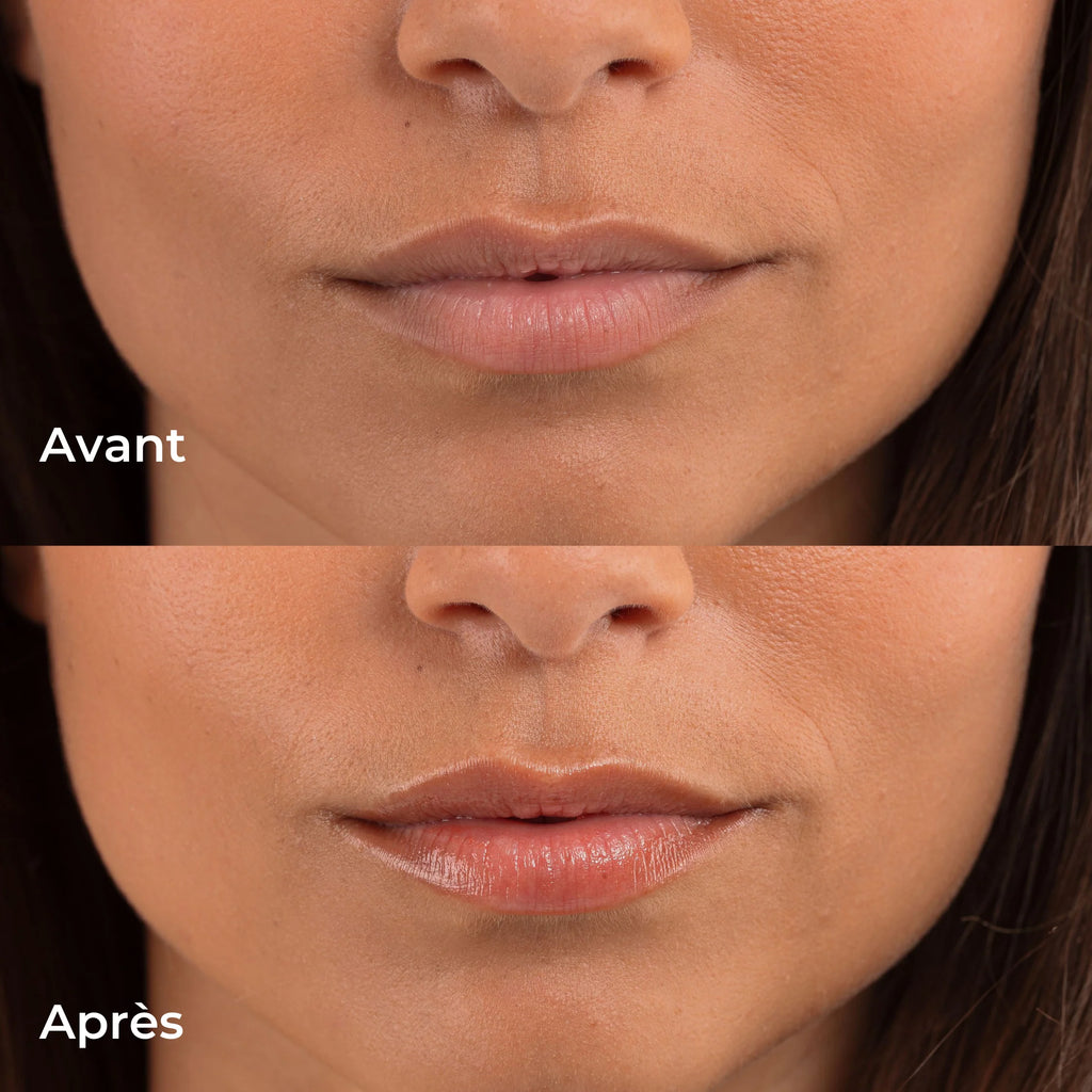 Avant/Après Baume lèvres teinté naturel et nourrissant 