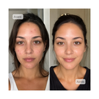 Neodermy LED-Gesichtsmaske – Rot- & Infrarot-Lichttherapie