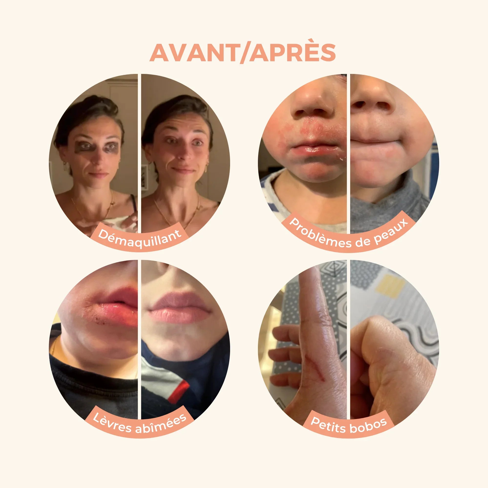 Avant/Après Baume Magique Avis Client Démaquillant Eczéma