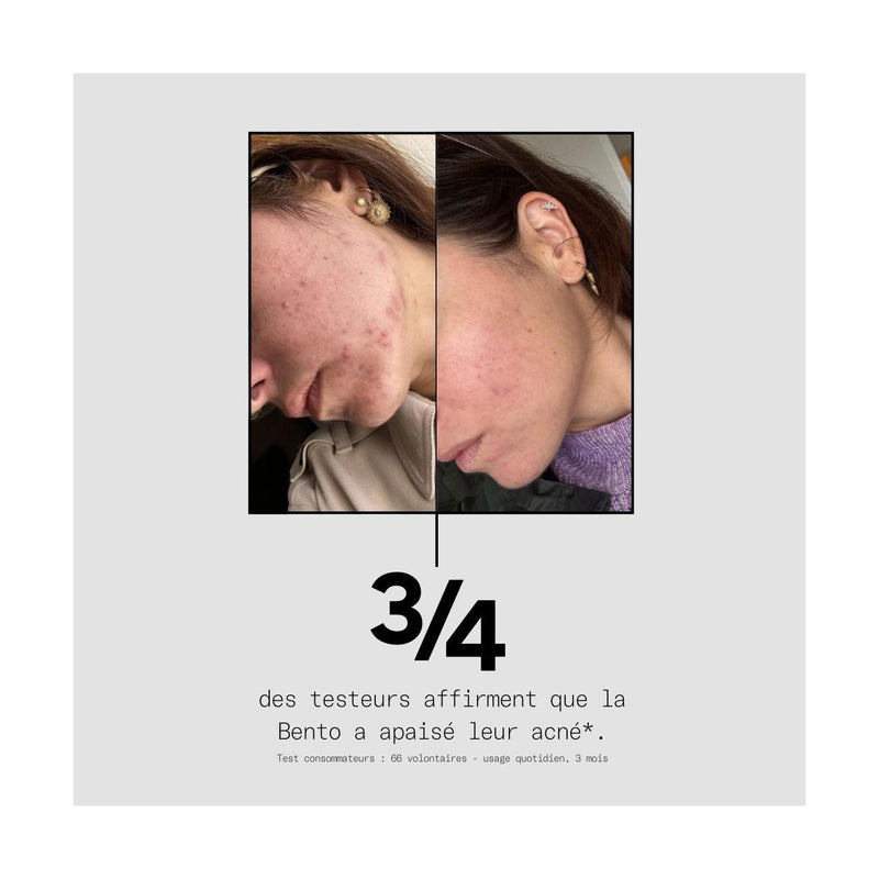 La Solution Complète Pour Tes Boutons - La Bento