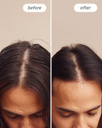 Instant Relief™ Dandruff Shampoo