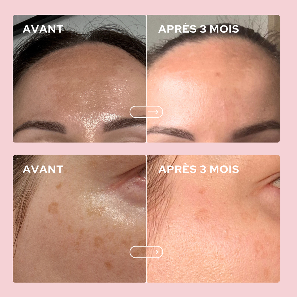 Beautiful Skin Duo