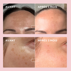 Beautiful Skin Duo