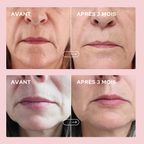 Beautiful Skin Duo