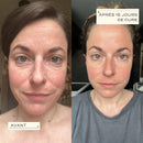 Collagen Essential - Skin Regeneration &amp; Elasticity