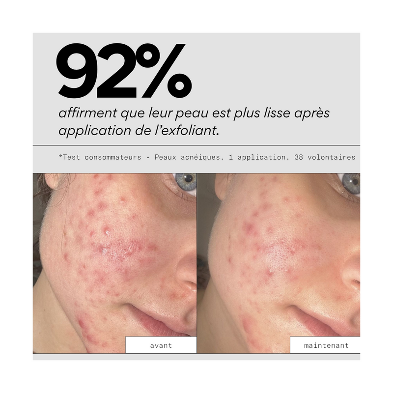 Peel Out - Masque Exfoliant