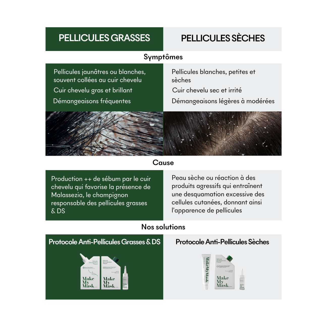 Protocole Anti-Pellicules Grasses & Ds