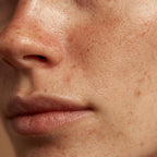 Peeling a Medida – Manchas, Poros y Luminosidad
