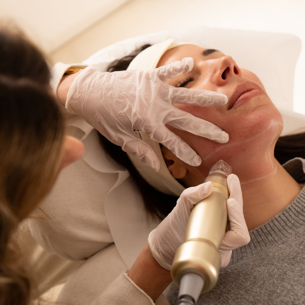 Morpheus8® Visage – 1 Séance Microneedling + Radiofréquence